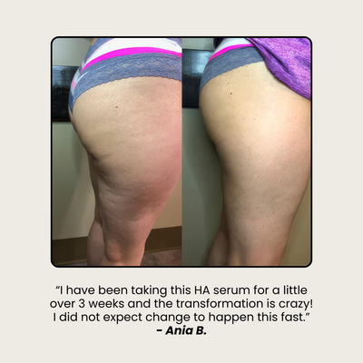 Hyaluronic Acid Serum